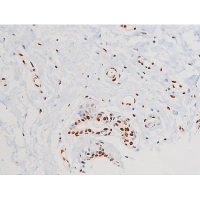 MAPK8 / JNK1 Antibody (phospho-Thr183,pTyr185)