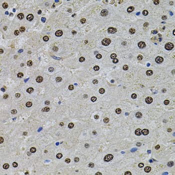 SR140 / U2SURP Antibody