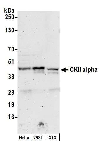 CSNK2A1 Antibody (aa300-350)