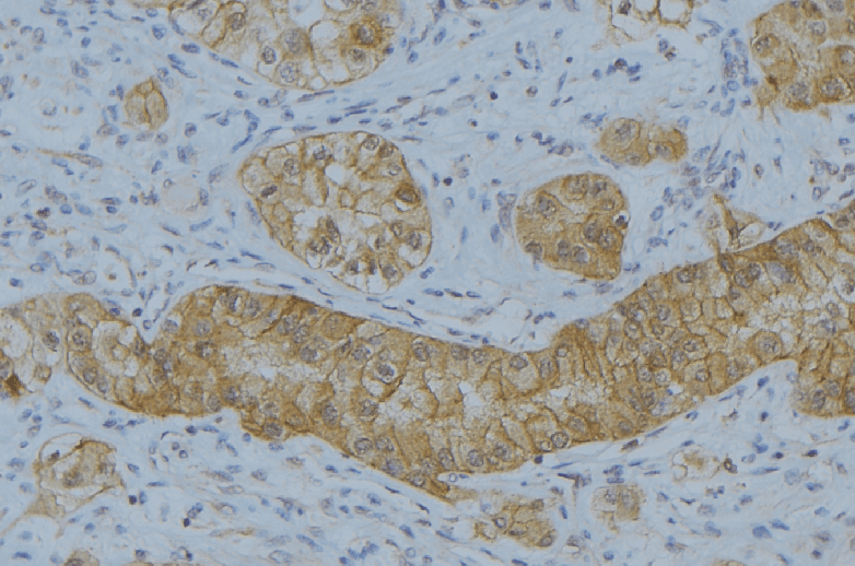 Polyclonal Rabbit anti-Human MMP7 / Matrilysin Antibody (IHC, IF, WB)