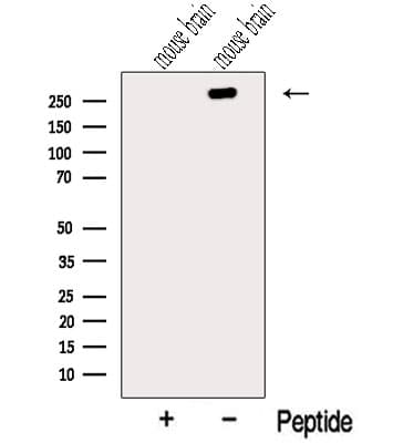TNM / Teneurin-1 Antibody