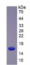 Mouse SLIT2 Protein (Recombinant His, N-Terminal)