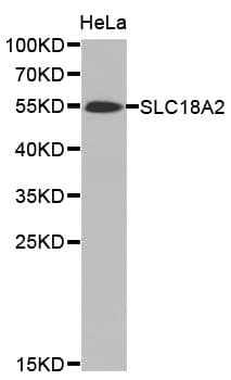 Polyclonal Rabbit anti-Human SLC18A2 / VMAT2 Antibody (IHC, WB)
