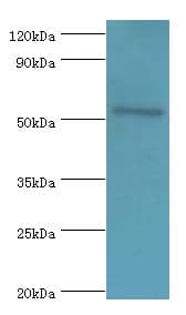 Polyclonal Rabbit anti-Human CAMK4 / CaMK IV Antibody (aa304-473, WB)