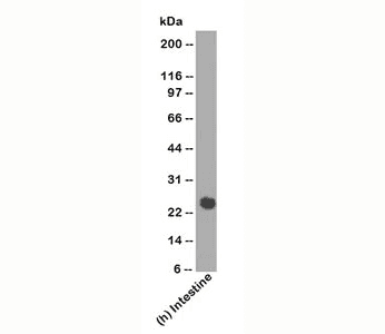 Lambda Light Chain Antibody (clone LcN-2 + ICO-106)