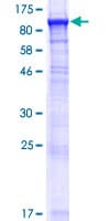 Human ACSBG1 / hsBG Protein (Recombinant GST)
