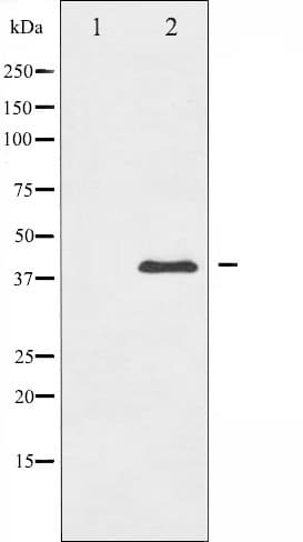 MAP2K3 / MEK3 / MKK3 Antibody