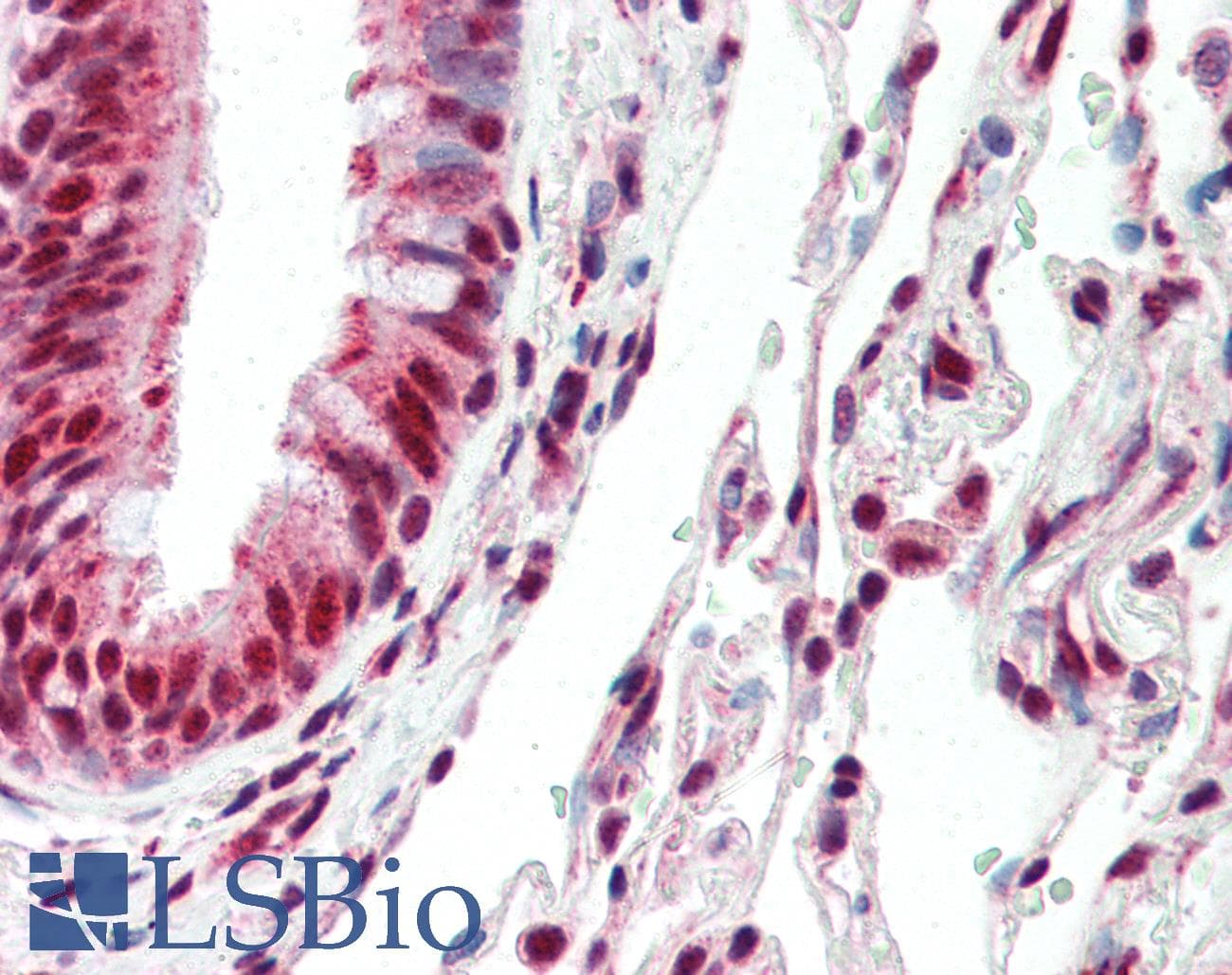 IHC-plus™ Polyclonal Rabbit anti-Human ID3 Antibody (C-Terminus, IHC)