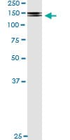 PDGFRB / PDGFR Beta Antibody (clone 4C12)