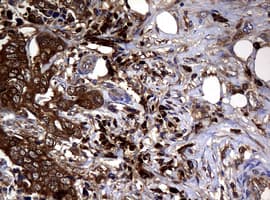 NME1 / NM23 Antibody (clone OTI2H10)