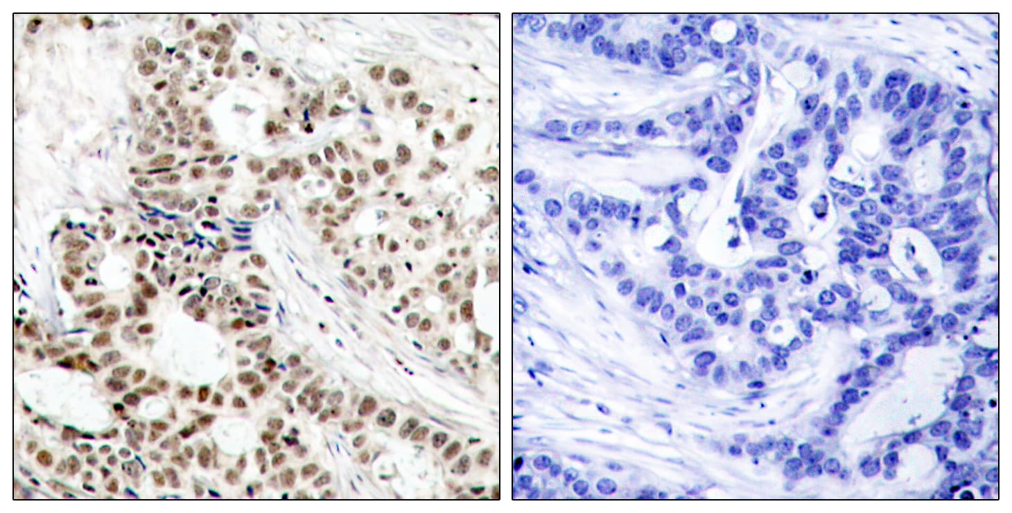 BRCA1 Antibody (phospho-Ser1423)