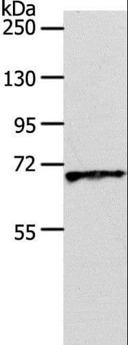 SLC22A3 / OCT3 Antibody