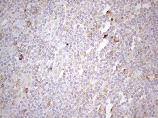 PODXL / Podocalyxin Antibody (aa32-461, clone OTI2C6)