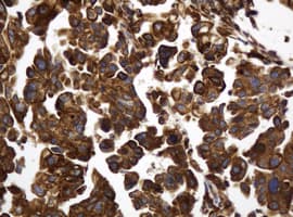 Monoclonal Mouse anti-Human TAPBPL / TAPBPR Antibody (clone OTI3D8, IHC, WB)