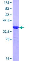 Human NBEA / Neurobeachin Protein (Recombinant GST, N-terminus)