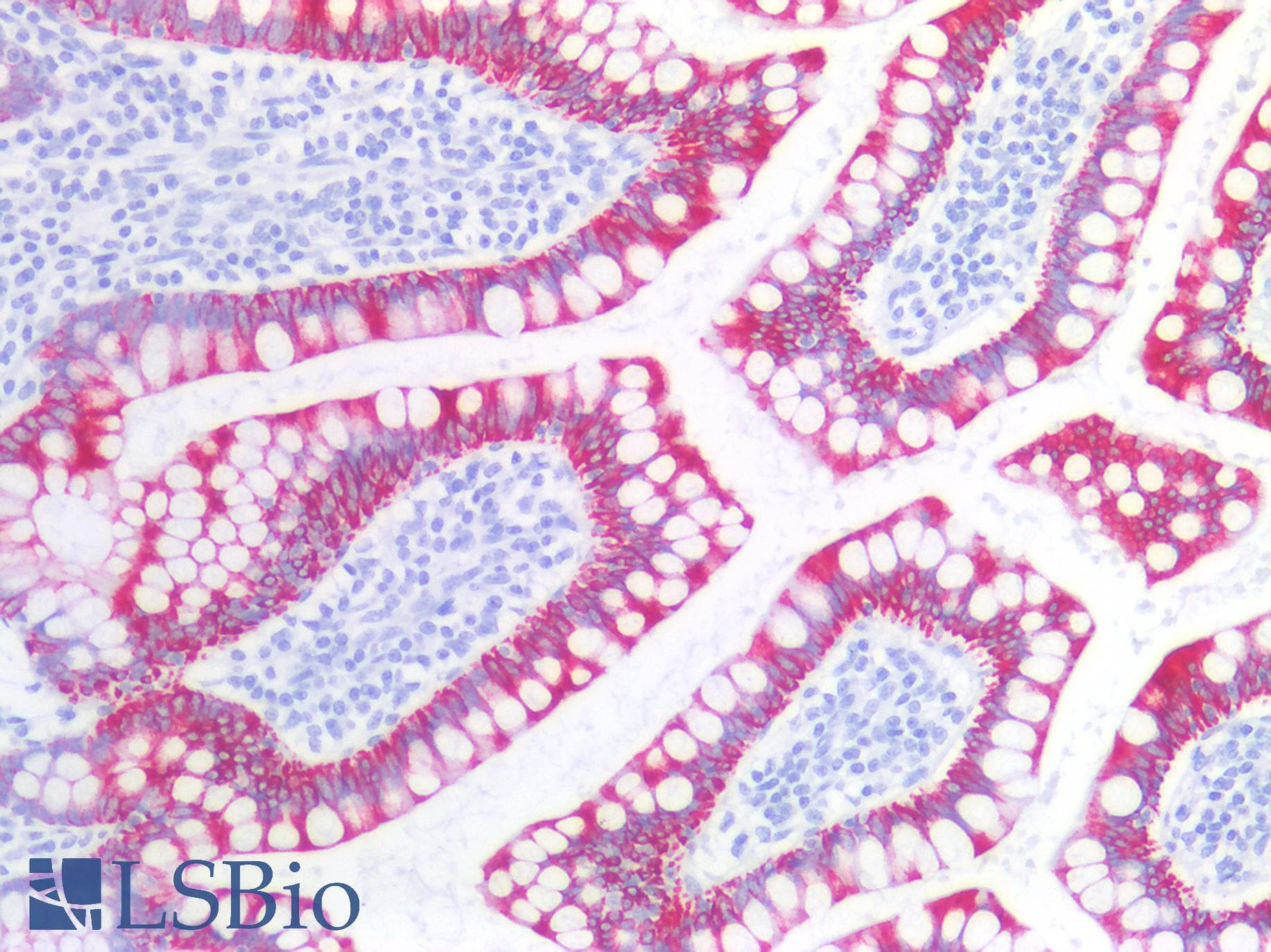 PathPlus™ KRT19 / CK19 / Cytokeratin 19 Antibody (clone A53-B/A2)