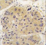 EIF4A1 Antibody (aa1-30)