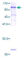 Human SRPR Protein (Recombinant GST)