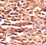 PP2Ac / PPP2CA Antibody (aa1-30)