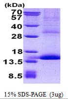 Human GP9 / CD42a Protein (Recombinant His)