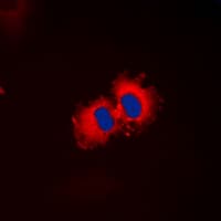IHC-plus™ RALDH2 / ALDH1A2 Antibody (C-Terminus)