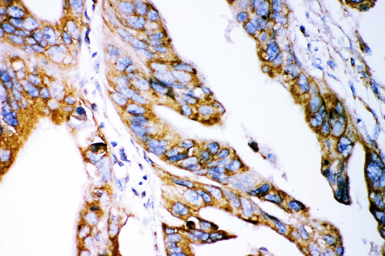 CLDN2 / Claudin 2 Antibody (aa38-230)