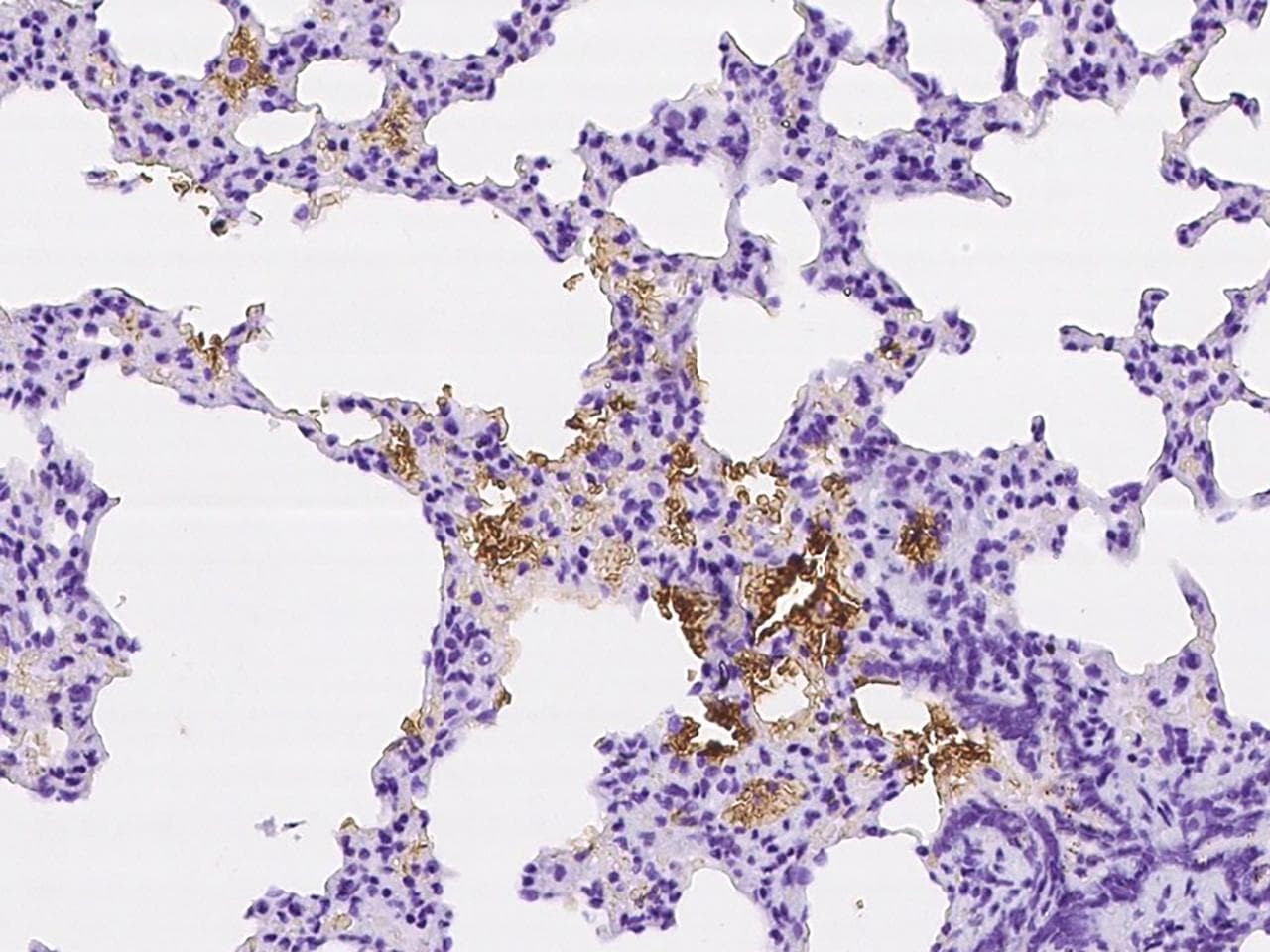 SLC4A1 / Band 3 / AE1 Antibody
