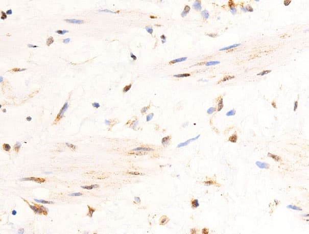 UCP3 Antibody