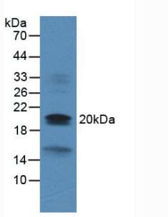 DUSP3 / VHR Antibody (aa2-185)
