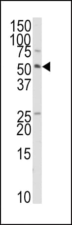 IHC-plus™ TRAIP / TRIP Antibody (aa328-356)