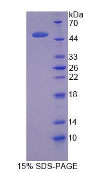 Human SLC1A5 / ASCT2 Protein (Recombinant His-GST)