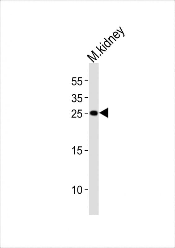 CLDN6 / Claudin 6 Antibody (aa186-229)