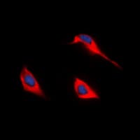 SLC52A1 / GPR172B / PAR2 Antibody (Internal)