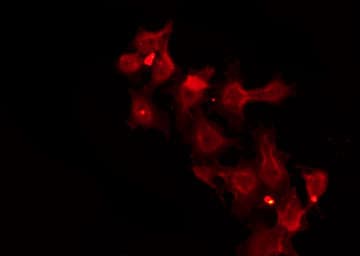 SLC39A2 / ZIP2 Antibody