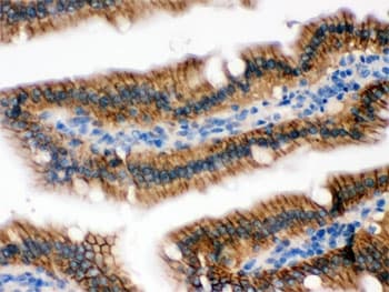 Polyclonal Rabbit anti-Human RENT1 / UPF1 Antibody (IHC, WB)