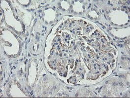 RIPK1 / RIP Antibody (aa133-422, clone OTI2D6, Carrier-free)