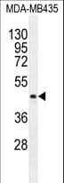 LIPK Antibody (aa359-388)
