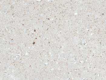 CALB2 / Calretinin Antibody (clone CALB2/2603, Azide-free, BSA-free)