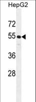 Polyclonal Rabbit anti-Human CCNJL Antibody (aa125-153, WB)