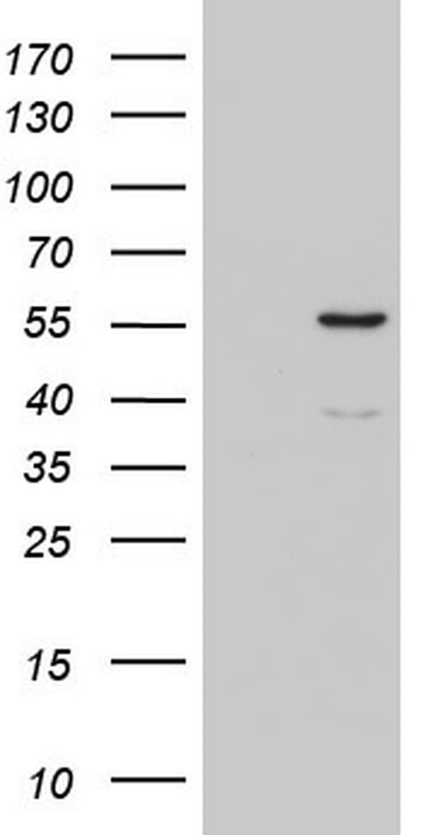 CFLAR / FLIP Antibody (aa1-272, clone OTI2D3)