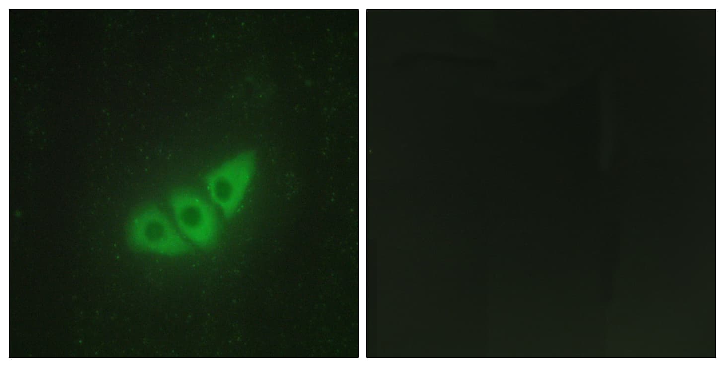 EIF2AK3 / PERK Antibody (aa61-110)