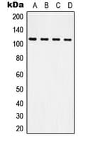 ITGB3 / Integrin Beta 3 / CD61 Antibody (C-Terminus)