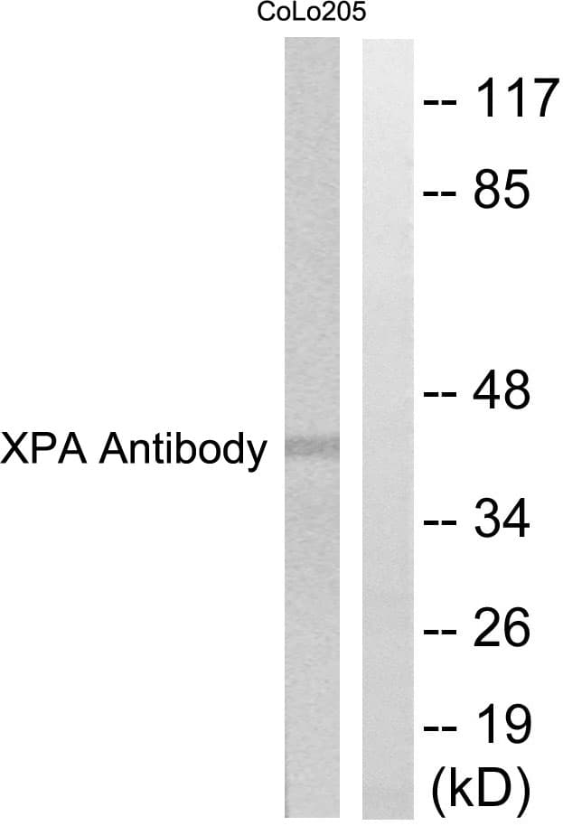 Polyclonal Rabbit anti-Human XPA Antibody (aa211-260, IHC, WB)