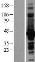 DCX / Doublecortin Protein (Over-Expression Lysate Myc-DDK (Flag))