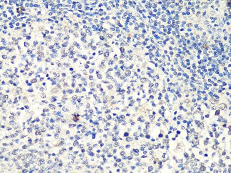 MTA2 Antibody