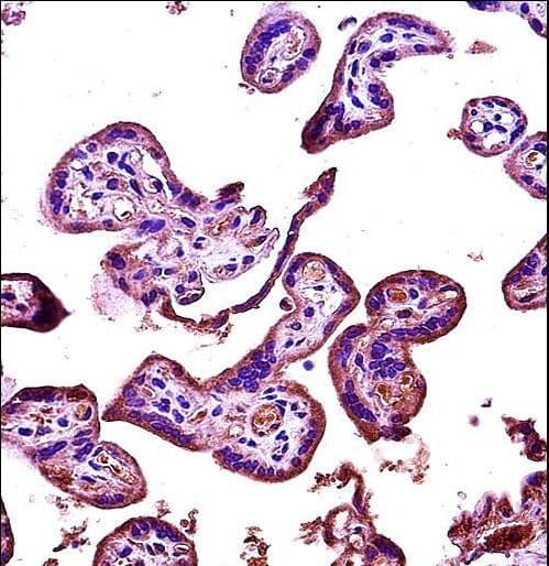 RICK / RIP2 Antibody (aa39-68)