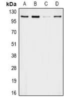 Polyclonal Rabbit anti-Human APOB / Apolipoprotein B Antibody (WB)
