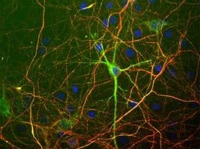 Polyclonal Chicken anti-Bovine NEFH / NF-H Antibody (IF, WB)