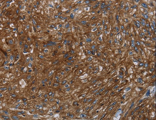 KISS1R / GPR54 Antibody