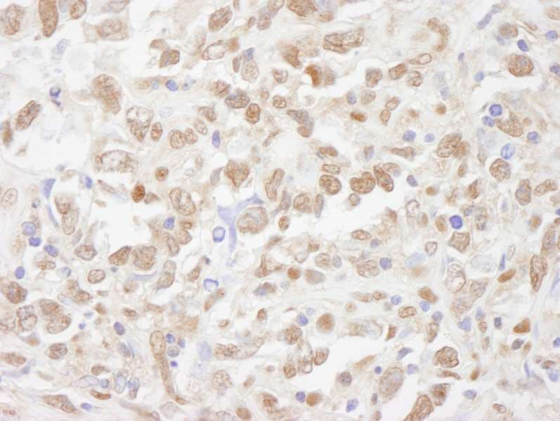 Polyclonal Rabbit anti-Human PSMC5 / SUG1 Antibody (aa1-50, IHC, WB)